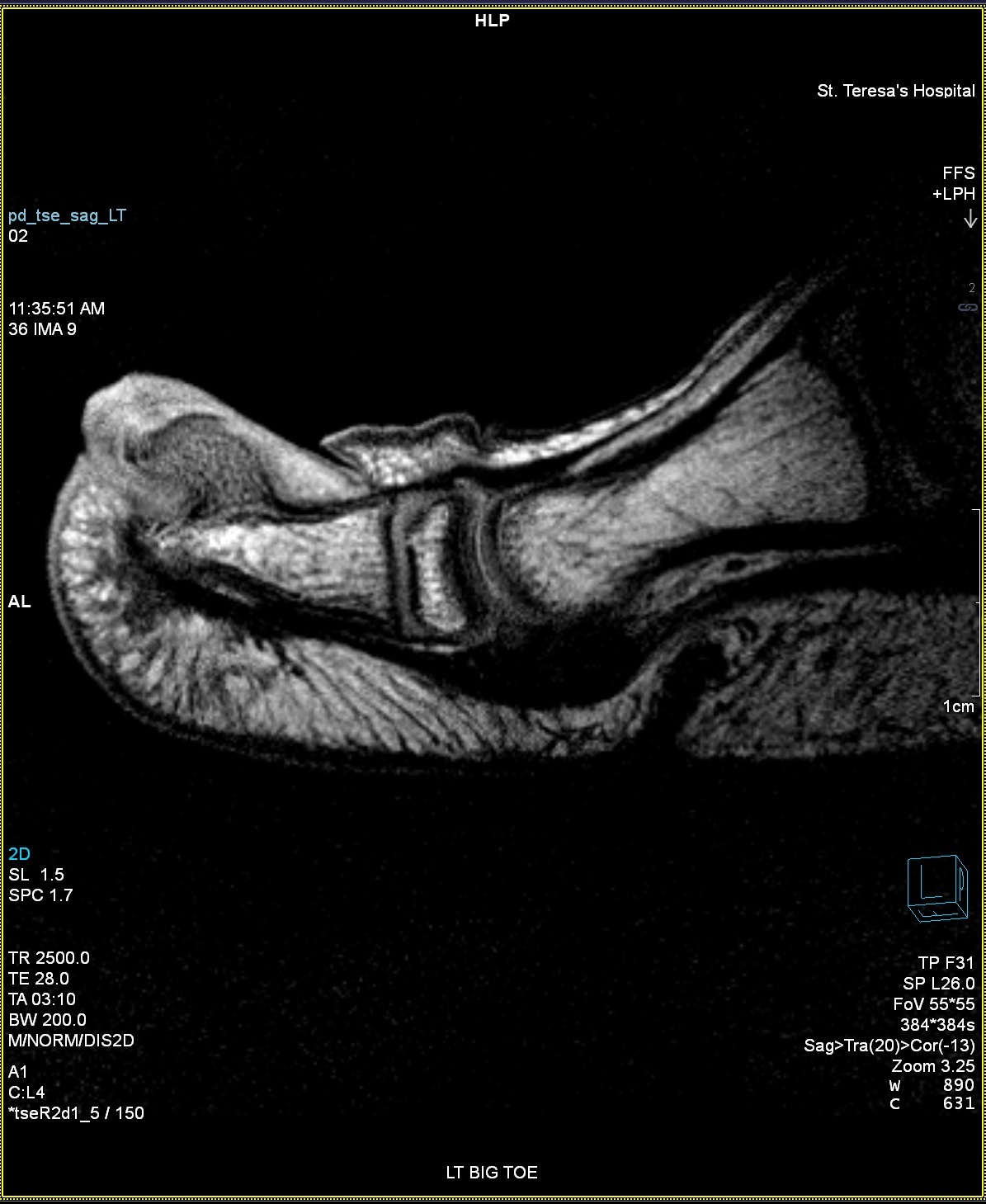 High Resolution Small Part (Toe)